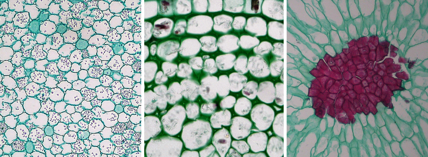 3-Panel photographic figure. Panel 1: Parenchyma cells from a root in cross section. Panel 2: Collenchyma cells from a stem in cross section. Panel 2: Stone cells, a type of sclerenchyma, from the flesh of a pear.