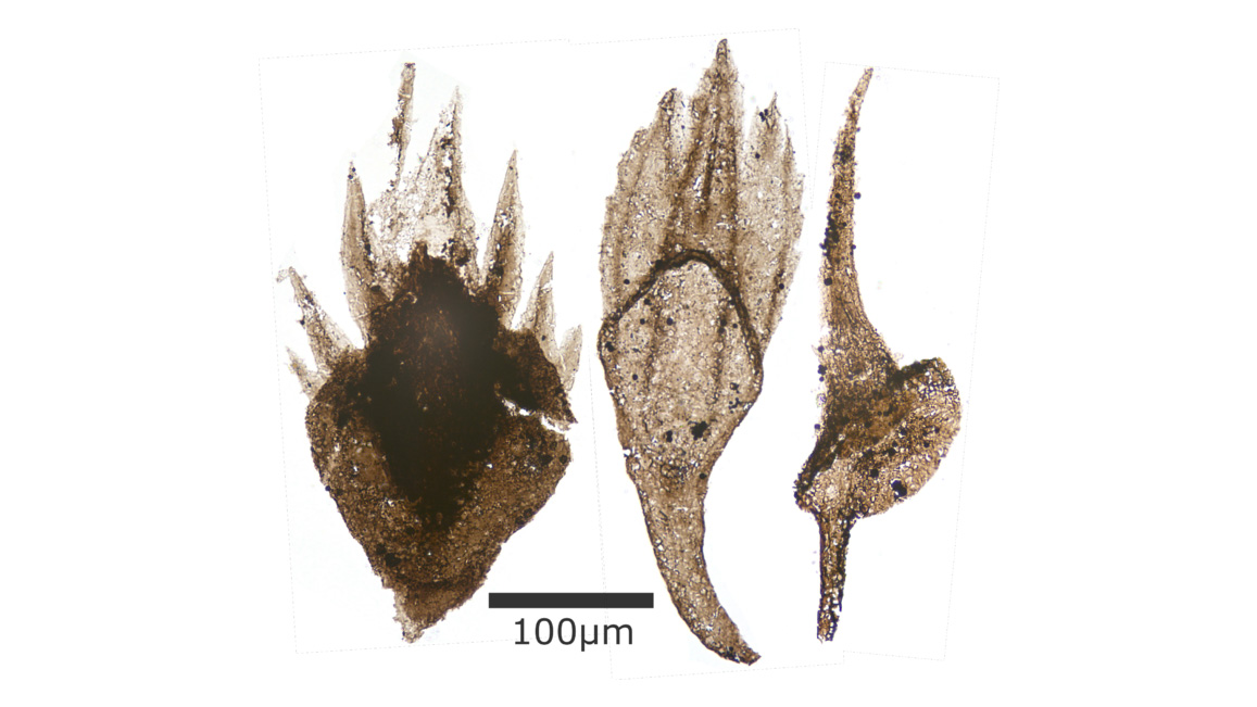 Photograph of thelodont scales.