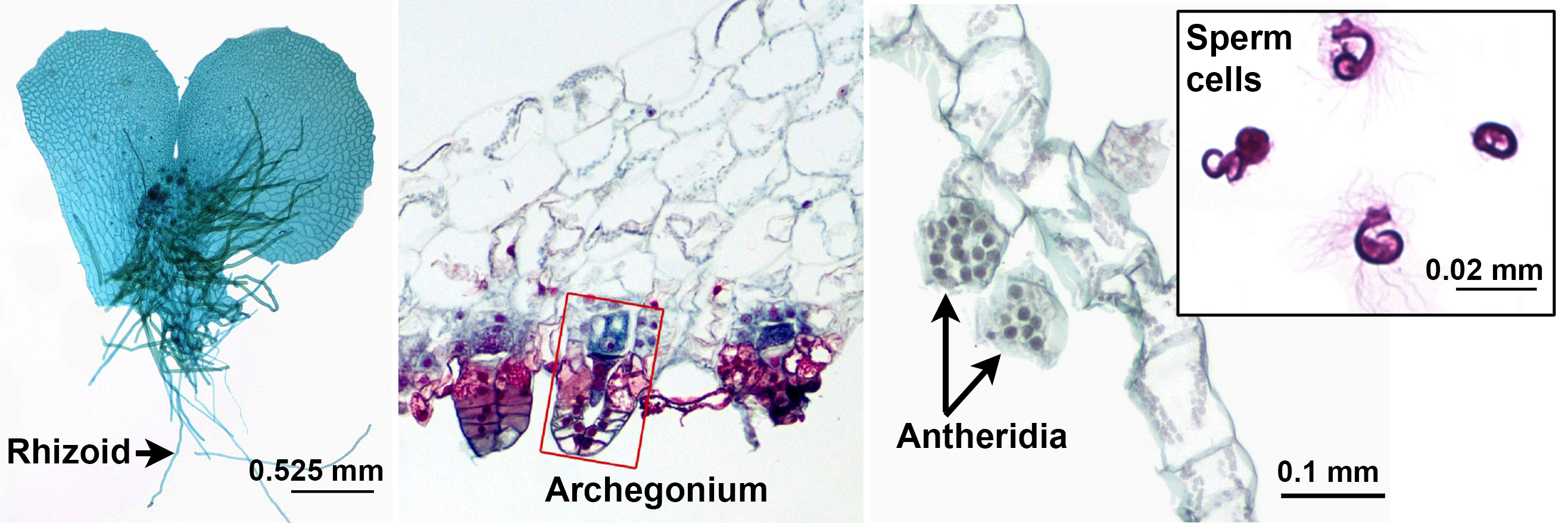 3-Panel figure of gametophyte structures of a fern. Panel 1: Heart-shaped gametophyte. Panel 2: Detail of archegonia. Panel 3: Detail of antheridia. Inset of Panel 3: Mature sperm cells.
