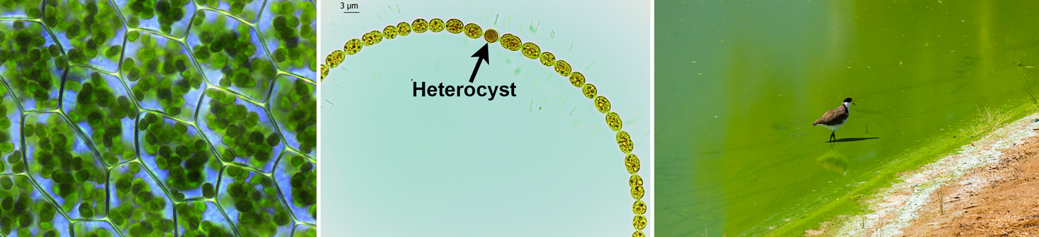 3-Panel figure: Panel 1: Chloroplasts in the cells of a moss. Panel 2: A filamentous cyanobacterium with heterocyst. Panel 3: A bloom of cynobacteria in a lake makes the water look bright green.