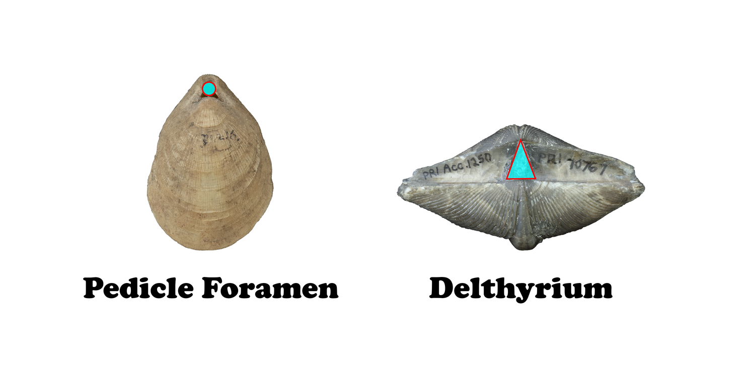 Comparison of pedicle foramen and delthyrium
