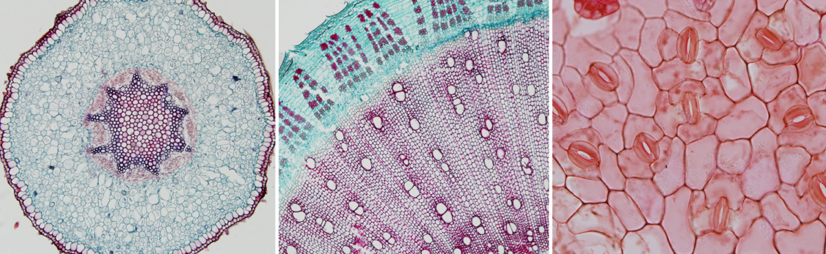 Photos of anatomical sections of plant organs. Left: Cross section of a root. Center: Cross section of a woody stem. Right: Epidermis of a leaf.